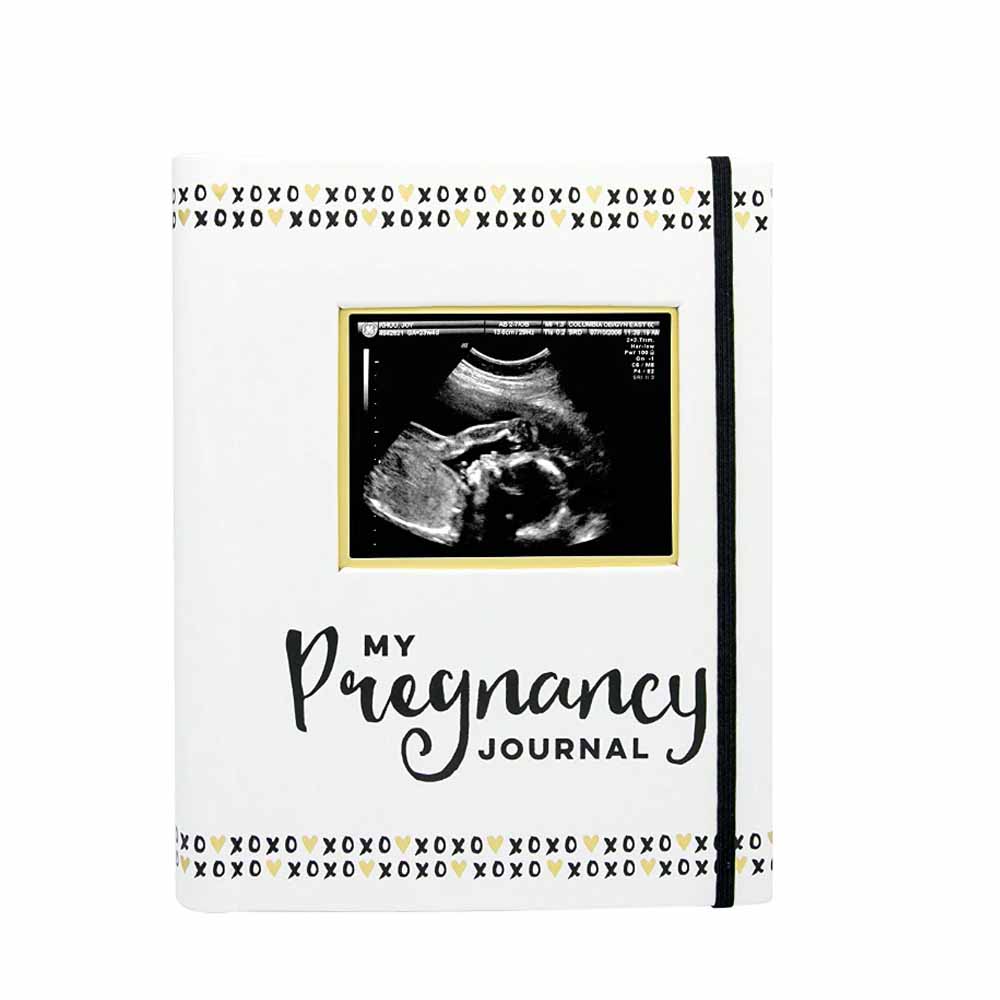 White book cover with black font and picture of an ultrasound scan for My Pregnancy Journal